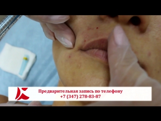 porn красивые губы важнейший элемент гармоничного лица hd