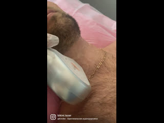 porn видео от bikinilazer лазерная эпиляция в самаре hd