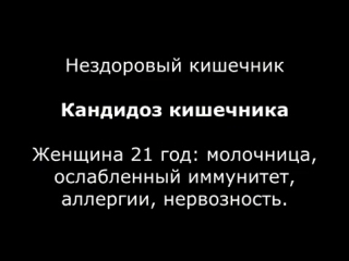 porn колоноскопия кишечника видео очищение организма hd