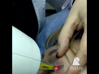 porn удаление нежелательного татуажа мастер косметолог шевцова амалия hd