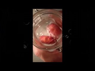 porn трилогия жизнь под дождём 1 полноценная жизнь 2 кастрация 3 усечение машонки hd