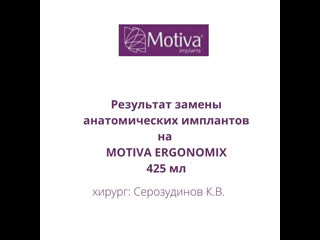 porn замена анатомических имплантов на ьщешмф укпщтщьшя hd