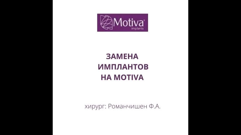 porn замена имплантов через 18 лет после устанои hd