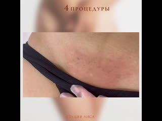 porn видео от лиса лазерная эпиляция чебоксары казань й ола hd