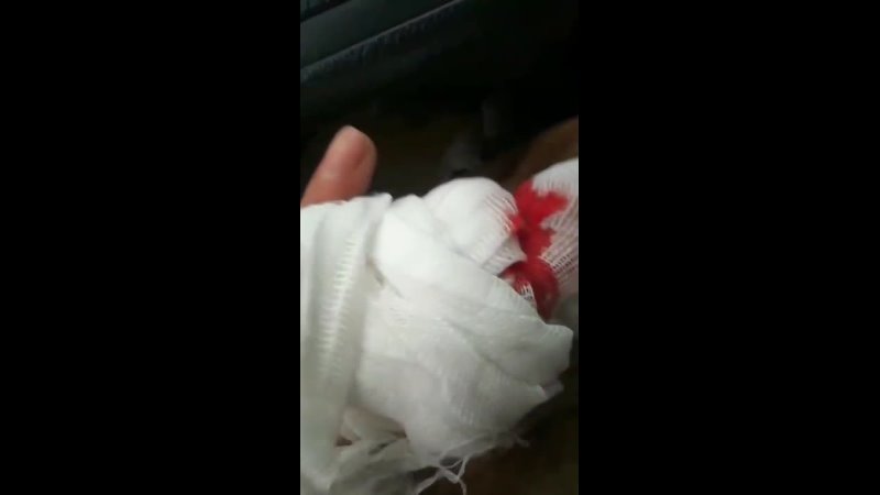 porn мужик отрезал себе палец циркуляркой и срочно выехал в больницу hd