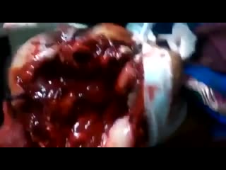 porn бразильянка молодые после того как в ее лицо запустили фейерверк hd