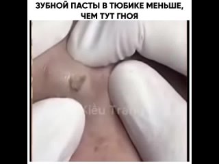 porn зубной пасты в тюбике меньше чем тут гноя hd