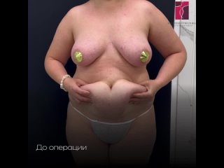porn видео от пластический хирург ермилова евгения валерьевна hd