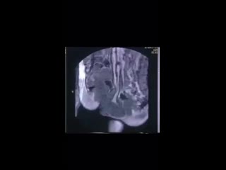 porn секс во время мрт необычный эксперимент проведенный 20 лет назад доктором тони деламотом опубликован в bmj hd