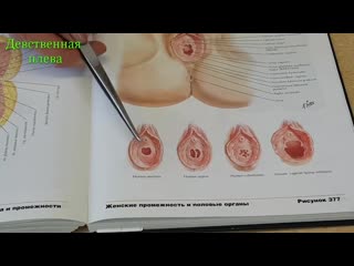 porn девственная плева и ее аномалия hymen hd