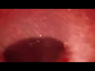 porn камера внутри пизды кончание крупным планом скрытая камерапорноинц hd