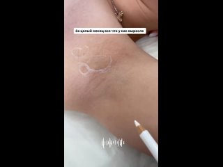 porn видео от лазерная эпиляция восковая армавир nasti sugari hd