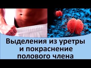 porn выделения из уретры и покраснение полового члена hd