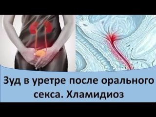 porn зуд в уретре после орального секса хламидиоз hd
