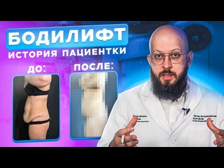 porn невероятная трансформация бодилифт и липосакция hd