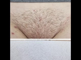 porn видео от лазернаяэлектро эпиляция стерлитамак hd