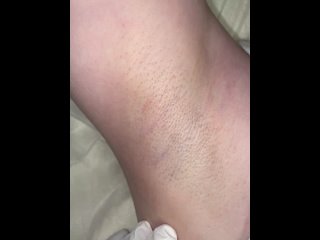 porn видео от лазерная эпиляция массаж одинцовотрехгорка hd