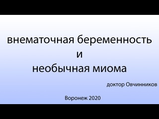 porn внематочная беременность и необычная миома матки hd