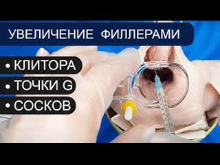 porn увеличение клитора точки g сосков филлерами контурная пластика гиалуроновая кислота hd
