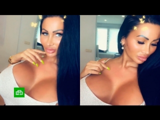 porn немецкая барби закачала в грудь 10 литров силикона hd