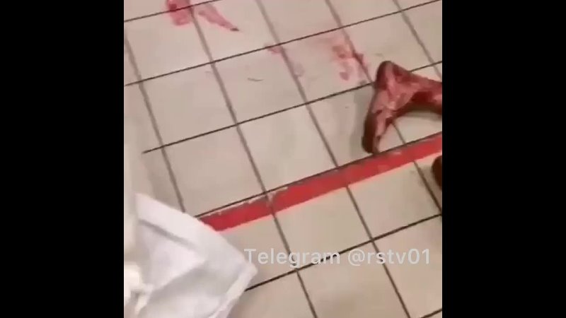 porn в станице мечетинской бультерьер покусал своего хозяина в магазине hd
