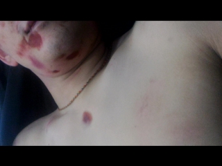 porn 18 осмотр трупа забитого насмерть парня 28 и лет служителями закона hd