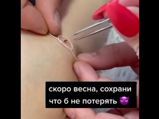 porn вот так надо вытаскивать клещей актуальная информация hd