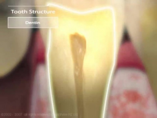 porn 3d анимация анатомия зубов и периодонта hd