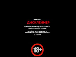 porn эндопротезирование молочных желёз в клиника нм hd