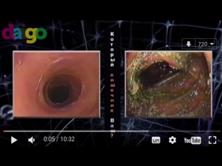 porn патогенная микрофлора почему развивается рак самая безопасная пища hd