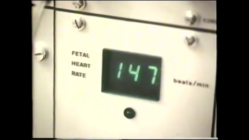 porn ведение родов роды правильное ведение родов maintaining a normal childbirth hd