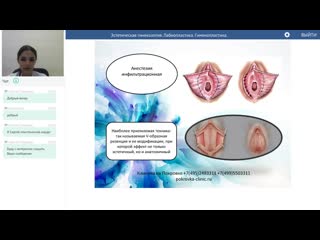 porn эстетическая гинекология лабиопластика гименопластика hd