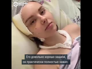 porn пострадавшая во время протестов в минске уже месяц в больнице hd