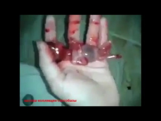 porn совсем маленький и еще живой абортированный ребенок hd