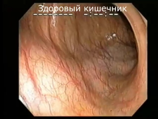 porn колоноскопия кишечника под наркозом процедура очищение организма от шлаков и токсинов в домашних условиях отзывы цена hd