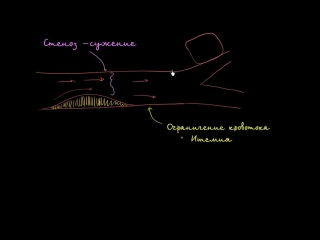 porn стеноз ишемия и сердечная недостаточность hd
