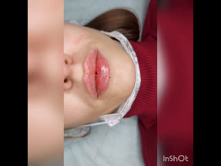 porn видео от косметология массаж лазерная эпиляция донецк hd