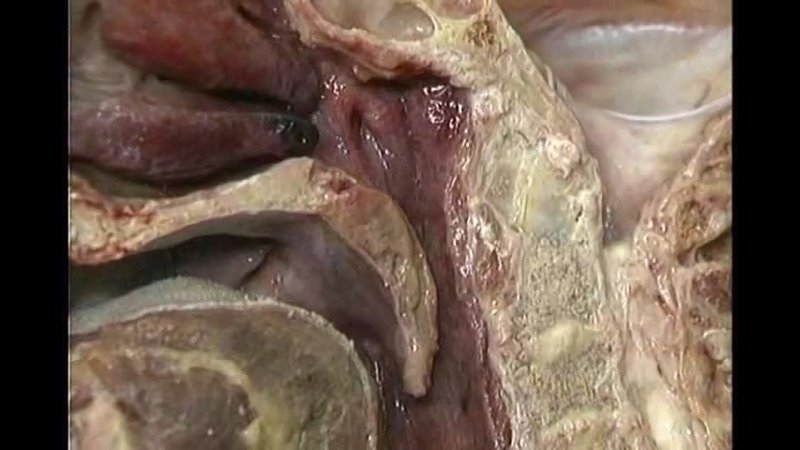 porn 逼毛浓密淫骚大波网红多多小树林演绎西游记勾引师父唐憎啪啪被三个徒弟轮番性报复 aclands dvd atlas human anatomy 4of6 head and neck part 1 mp3 wogre hd