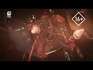 porn монстры внутри меня где у меня червь hd