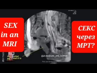 porn вам интересно как выглядит секс через аппарат мрт hd
