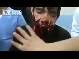 porn молодому парню снарядом оторвало челюсть страшное видео hd
