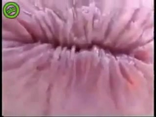 porn плавающая анальная трещина мышца сфинктера hd